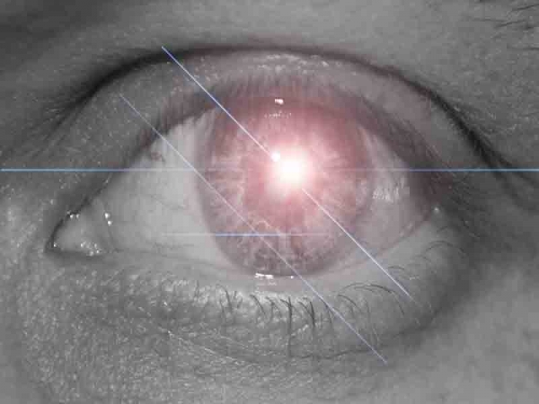 Creation of the eye....i guess....: Step 2